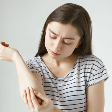 Hanseníase tem cura: procure auxílio especializado ao suspeitar dos primeiros sinais