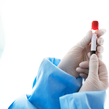 Design sem nome Hemofilia é genética e hereditária e tratamento foca na qualidade de vida