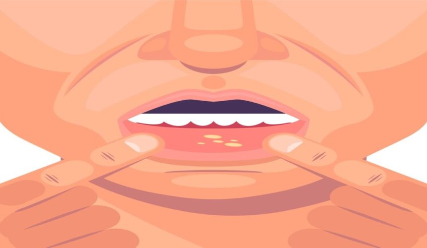 Cuidado com a saúde:  muitas doenças do corpo podem começar na boca