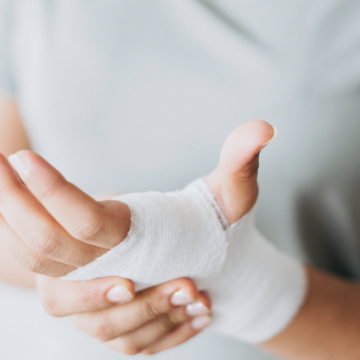 Saiba como evitar as queimaduras e o melhor procedimento diante delas